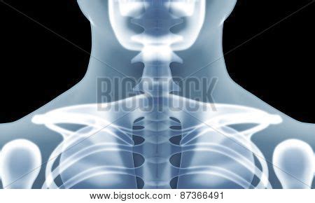 Human Skeleton Chest X Image Photo Free Trial Bigstock