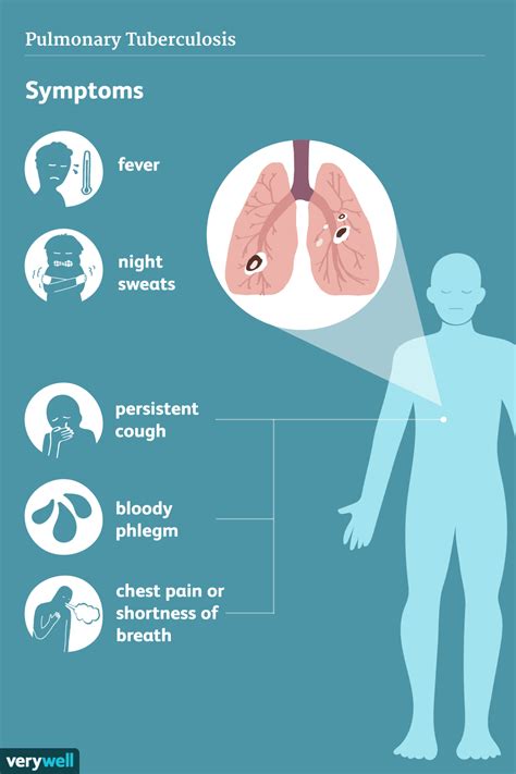 Tuberculosis: Signs, Symptoms, and Complications