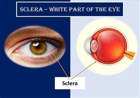 White Part Of The Eye Sclera Function Definition And Anatomy Health Kura