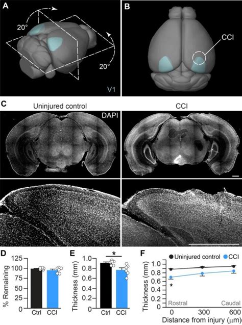 Primary Visual Cortex