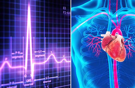 8 types of FDA-approved devices that treat the heart - Medical Design ...