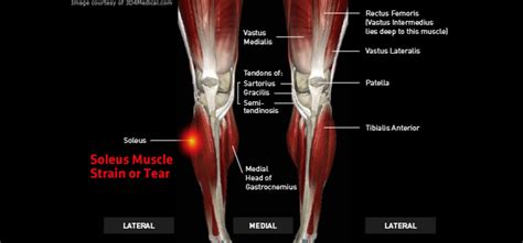 Calf Muscle Injury Symptoms Pictures to Pin on Pinterest - PinsDaddy