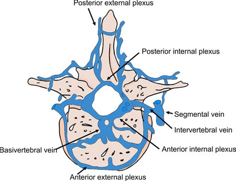 Graphic Representation Of The Vertebral Venous Plexuses [1] The