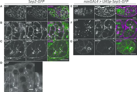 Sep Gfp And Sep Gfp Localize Similarly In Oogenesis Sep Gfp Ad