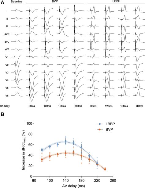 Left Bundle Branch Pacing Versus Biventricular Pacing For Acute Cardiac