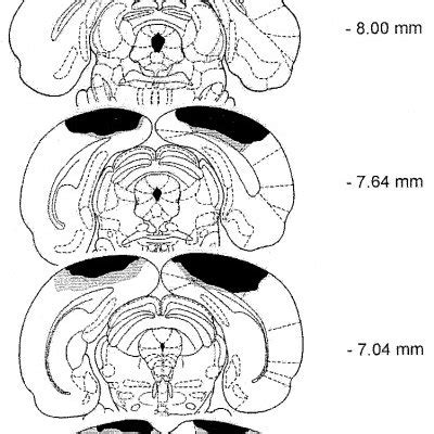 coronal sections   rat brain showing  extent  damage