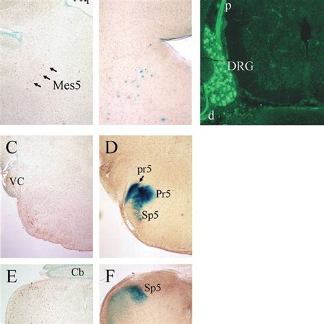 Brn3a 5 Flanking Sequences Target Reporter Gene Expression To The