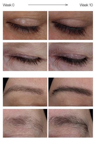 RefectoCil Lash Brow Booster Review Grow Healthy Eyelashes