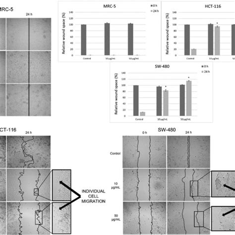 Pg Affected Collective Migration Of Mrc Hct And Sw Cells