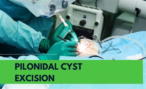 What Are The Steps For Pilonidal Cyst Excision Surgery Your Notable Guide