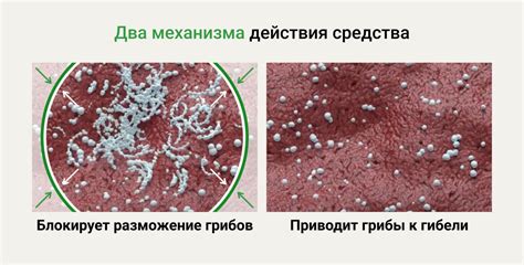 Молочница симптомы лечение свечи