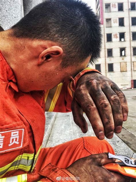 Fire Fighters Burn Scars Win Respect 8 Peoples Daily Online