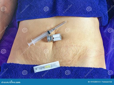 Female Abdomen With Stretch Marks Syringe And Ampoule Lie On The Navel