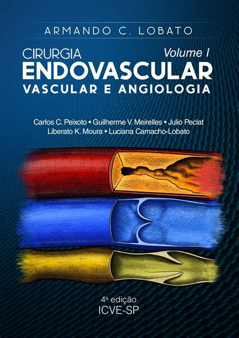 Cirurgia Endovascular 4a Edição by Douglas Rejowski Issuu