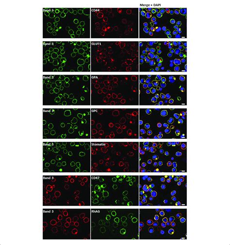 Marker Proteins In Cell Membrane