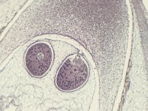 Pine Archegonium, Fertilization Slide | Boreal Science