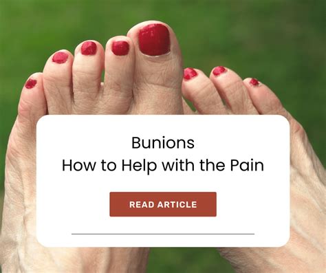 Bunions – How to Help with the Pain - Afana Pouliot