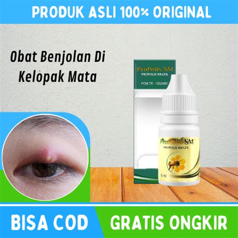 Jual Obat Penghilang Benjolan Di Kelopak Mata Salep Mata Bintitan