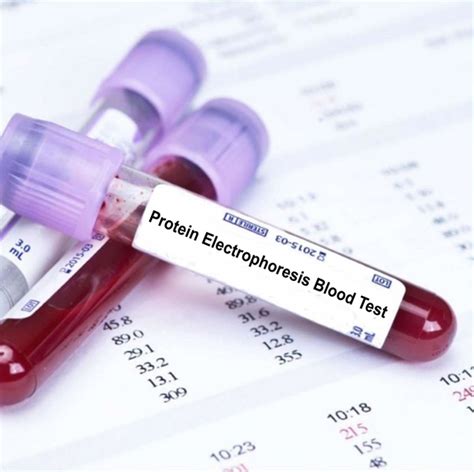 Protein Electrophoresis Blood Test | Blood Tests in London