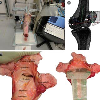 Patellofemoral Joint Kinematics During Knee Flexion A Representative