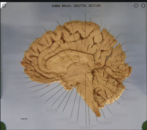 Sagittal Brain Section 2 Diagram Quizlet