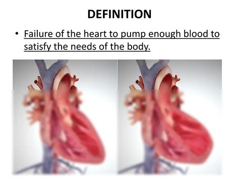 SOLUTION Cardiac Failure 2021 Studypool