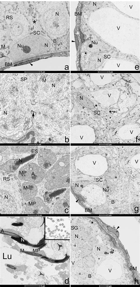 Transmission Electron Micrographs Of Testes From Control A D And