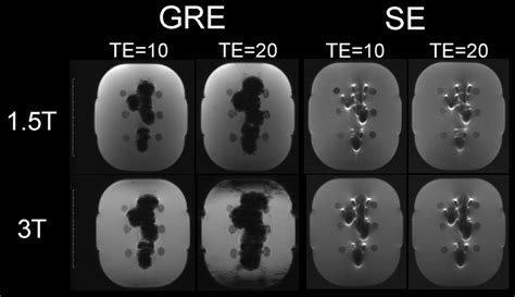 Comparison Between Gradient Echo Gre And Spin Echo Se Pulse