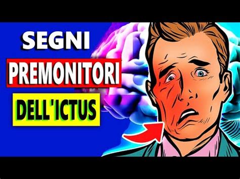 Non Ignorare I Primi Segnali D Allarme Dell Ictus YouTube