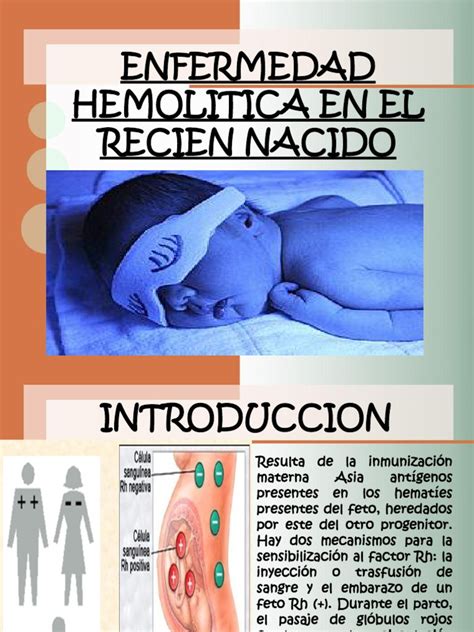 Enfermedad Hemolitica En El Recien Nacido Pdf Enfermedades Y Trastornos Medicina