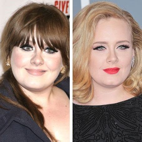 Adele before and after plastic surgery (18) – Celebrity plastic surgery ...