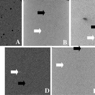 Micro Ct Analysis Of Two Dimensional Images For The Resin Groups A