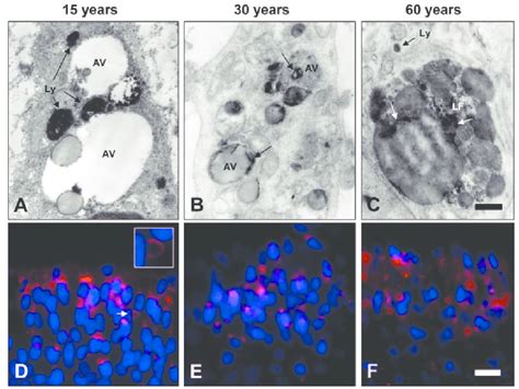 Lysosomal Markers In Human Odontoblasts A C Acid Phosphatase Download Scientific Diagram