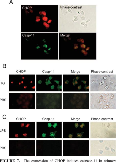 Figure 7 From Lipopolysaccharide Induced Inflammatio The Pathogenesis