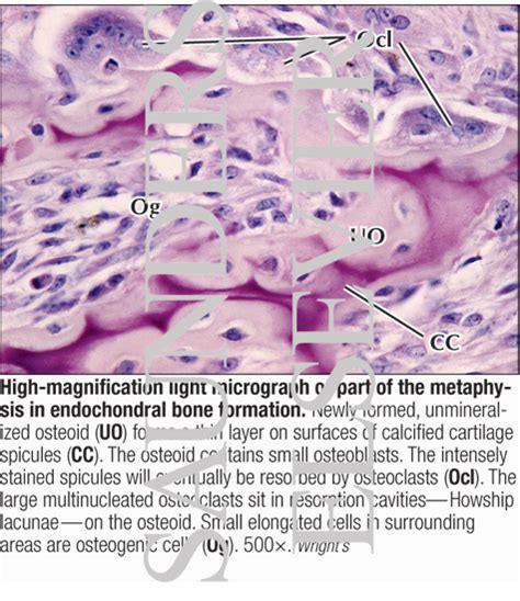 Endochondral Bone Formation Histology