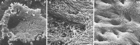 Frontiers The Elusive Endometrial Epithelial Stem Progenitor Cells