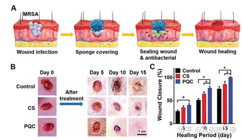 耐甲氧西林金黄色葡萄球菌感染创面的抗菌、止血、调节炎症和促进再生的聚合物复合海绵 知乎