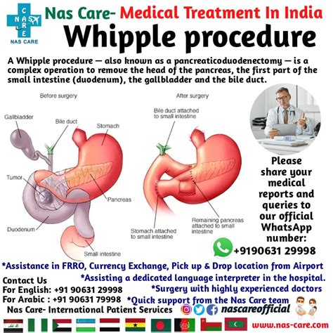 NAS CARE- ناس كير on LinkedIn: #whippleprocedure #whipplesurgery # ... 