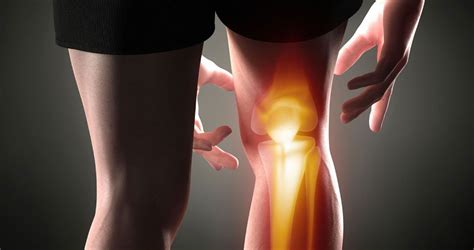 Gonalgia O Dolor De Rodilla Tratamiento Y Recuperaci N Mediante El