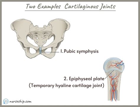 Different Types of Joints in The Human Body |Examples |Images ...