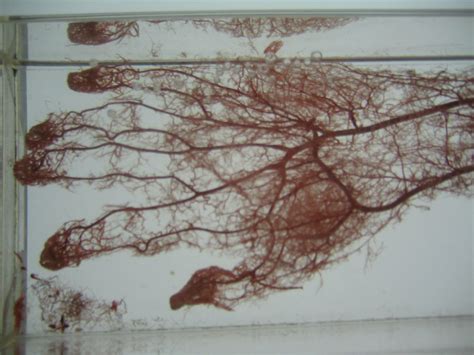 Body Worlds | Veins of the hand. --------------------- The B… | Flickr