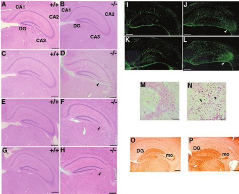 Abnormalities In Hippocampal Ca3 Subfields Of Stam1 Ϫ Ϫ Mice A To