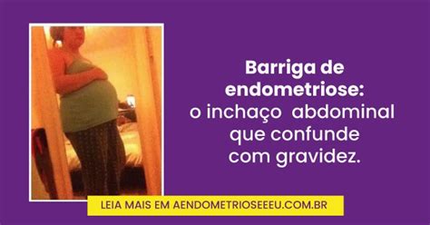 Endometriose Incha A Barriga - Barriga de endometriose: o inchaço abdominal que confunde com gravidez
