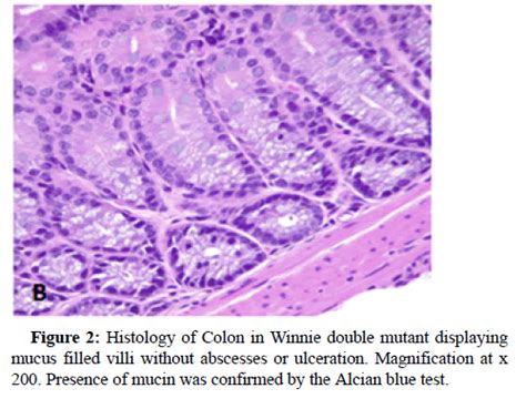 Mucosal Immunology Double