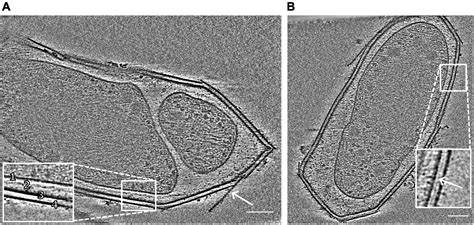 Cell Membrane Electron Micrograph