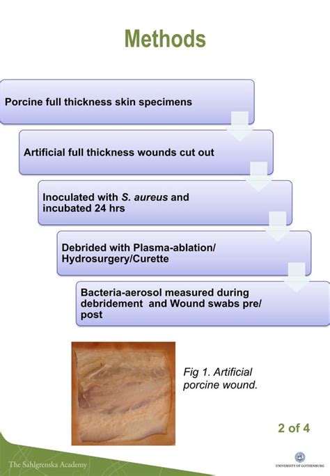 Ewma 2014 Ep448 Bacteria Aerosol Spread With Different Methods For