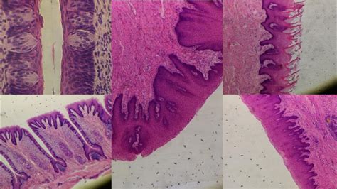 Tongue Filiform Circumvalate Fungiform Papillae Histo Slide Youtube