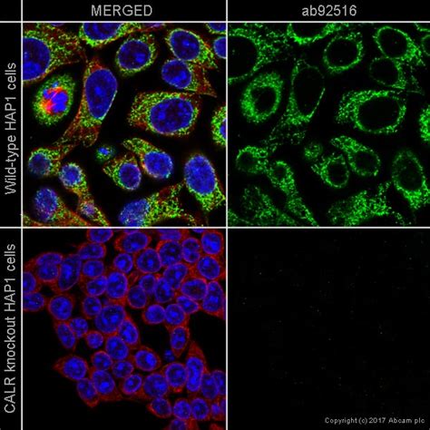 Recombinant Anti Calreticulin Antibody Epr3924 Bsa And Azide Free Ko Tested Ab271865