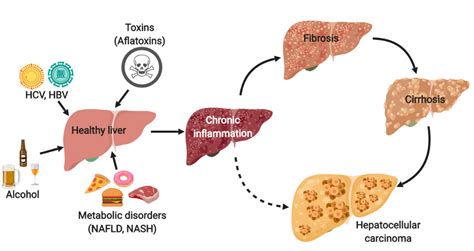 Cancers Free Full Text Animal Models Of Hepatocellular Carcinoma