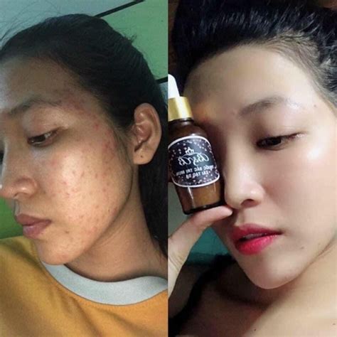San Pham Lam đep Shopee Việt Nam